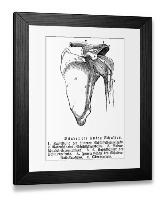 Framed Print : Tendons and joints of the left shoulder Framed Print : Tendons and joints of the left shoulder