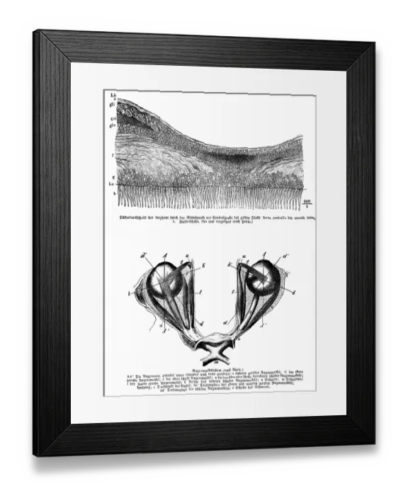 Framed Print : Average thickness of the retina through the center of the central pit of the yellow spot