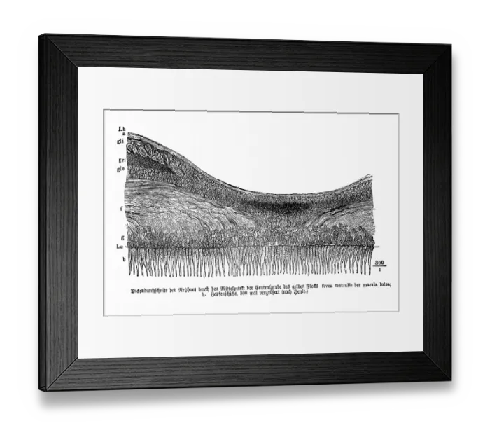 Framed Print : Average thickness of the retina through the center of the central pit of the yellow spot