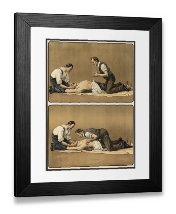 Framed Print : First aid, depiction of artificial respiration by two helpers