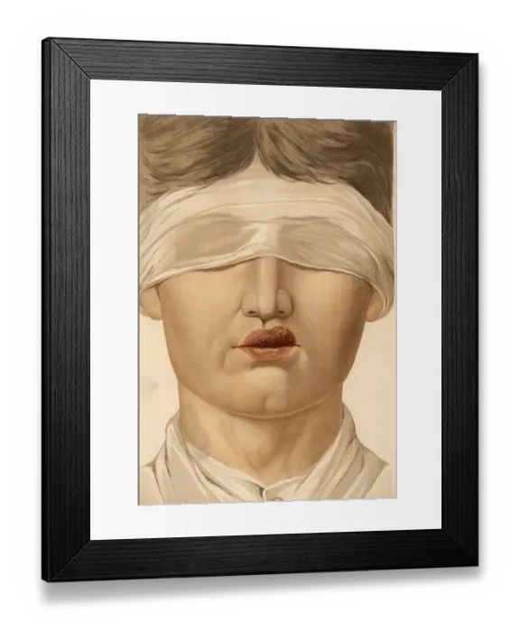 Framed Print : Medical illustration, clinical picture