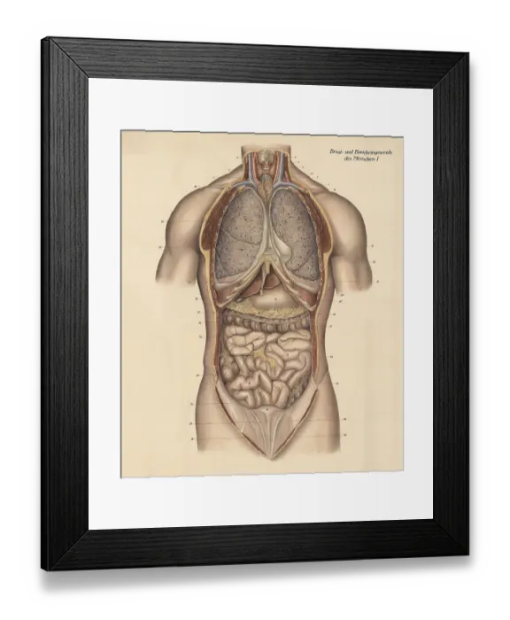 Framed Print : Medical illustration, intestines