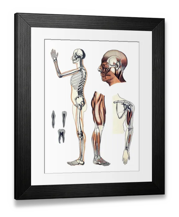 Framed Print : Medical illustration, human skeleton and muscles