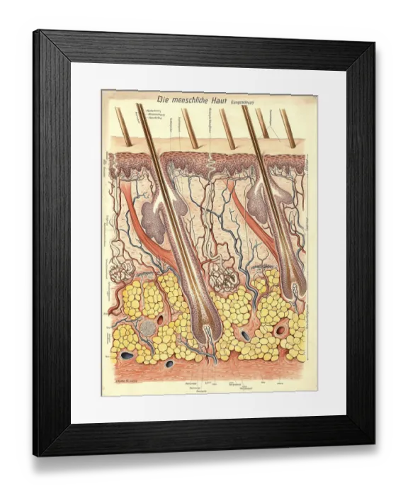 Framed Print : Medical illustration, structure of human skin Framed Print : Medical illustration, structure of human skin