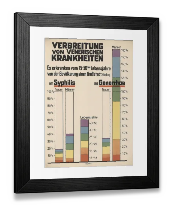Framed Print : Medical illustration, clinical picture Framed Print : Medical illustration, clinical picture