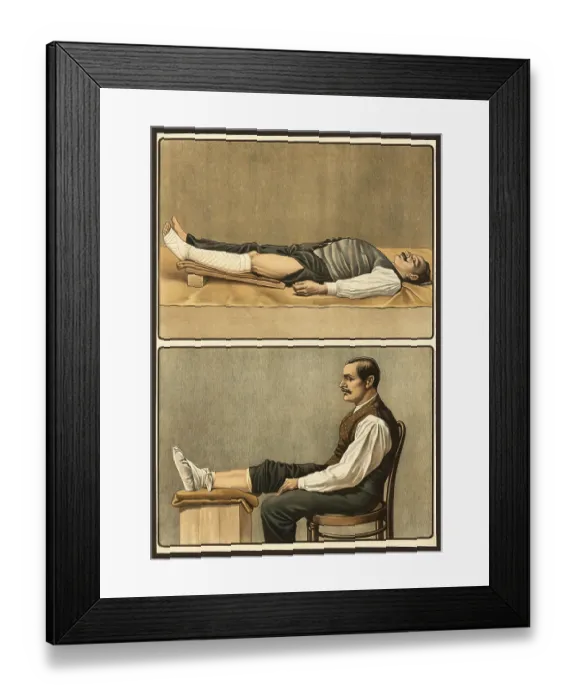 Framed Print : First aid, emergency bandage for varicose bleeding and injuries