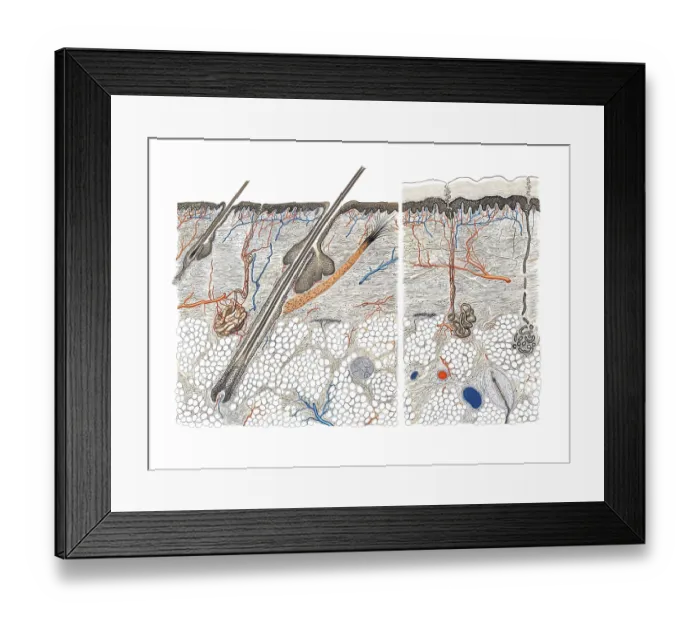 Framed Print : Medical illustration, cut through human skin and hair root