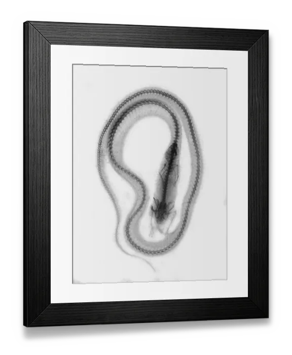 Framed Print : X-ray, X-ray. Snake that ate a mouse