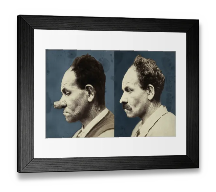 Framed Print : Cosmetic surgery, cosmetic surgery in front of Framed Print : Cosmetic surgery, cosmetic surgery in front of