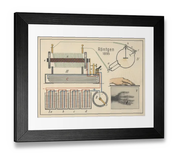 Framed Print : The illustration shows the first X-ray image of a human hand Framed Print : The illustration shows the first X-ray image of a human hand