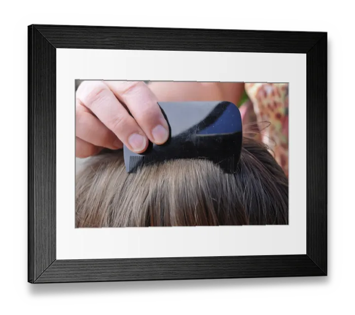 Framed Print : Hair being combed with a small-tooth comb in search of head lice and nits