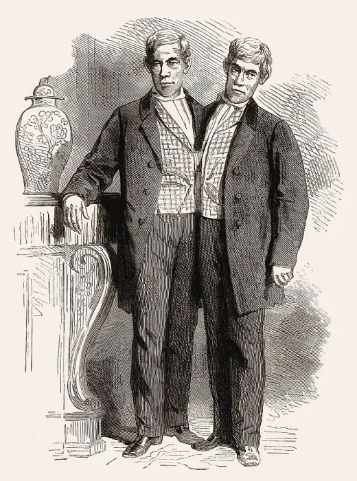 Framed Print : Chang and Eng Bunker, 1811-1874 Framed Print : Chang and Eng Bunker, 1811-1874