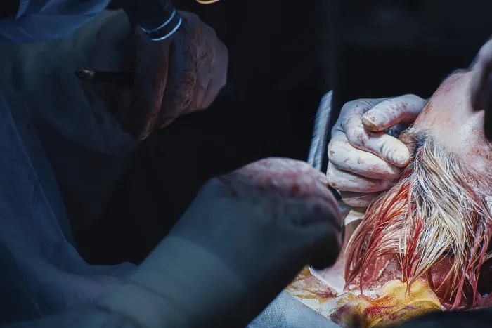 Framed Print : Close-up of a surgical procedure