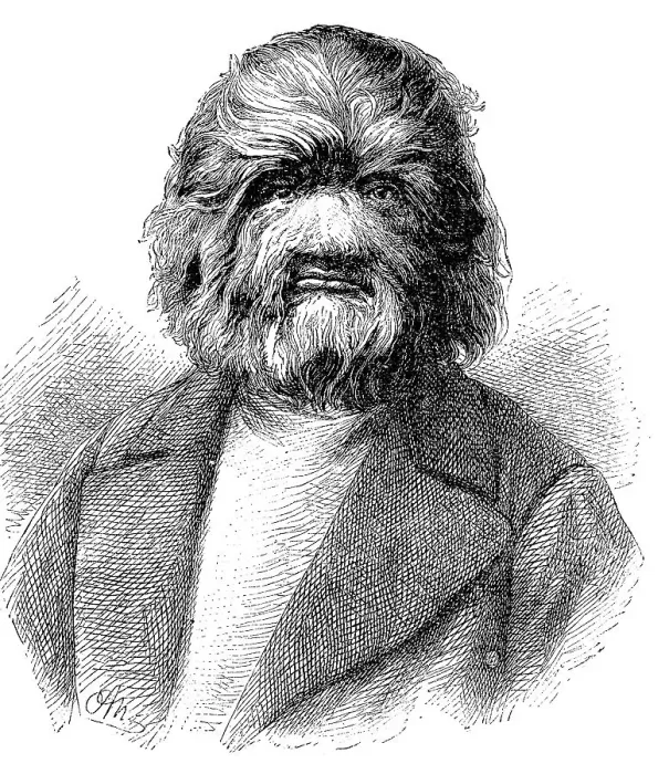 Framed Print : Dog-Faced Man, Fedor Adrianovich Jeftichew