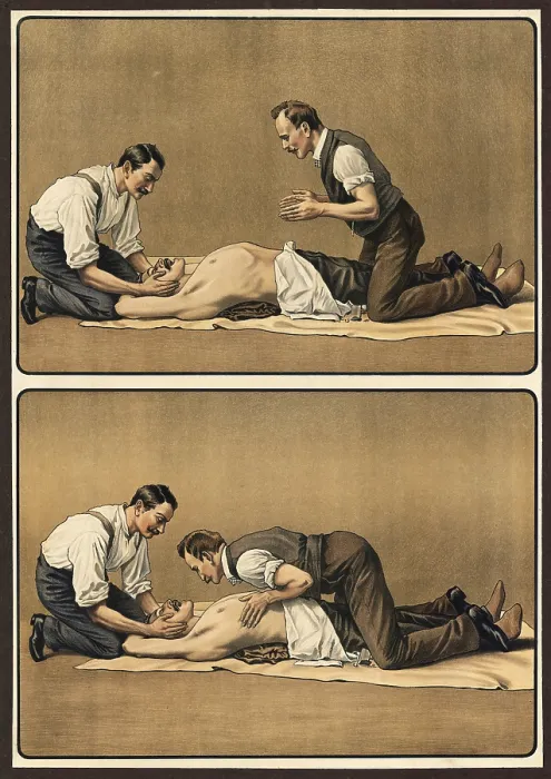 Framed Print : First aid, depiction of artificial respiration by two helpers
