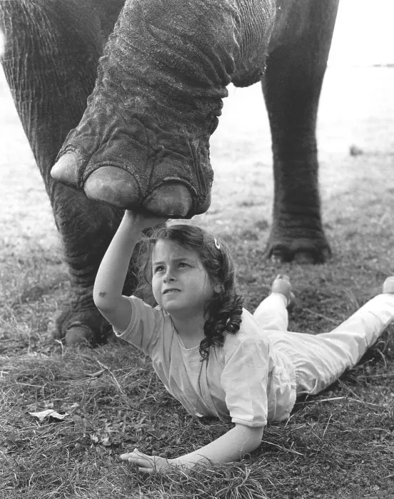 Framed Print : Girl with elephant leg, England, Great Britain