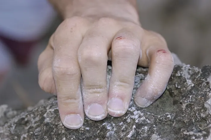 Framed Print : Hand of a sport climber Framed Print : Hand of a sport climber