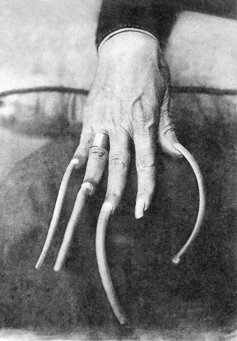 Framed Print : Historic photo, long fingernails
