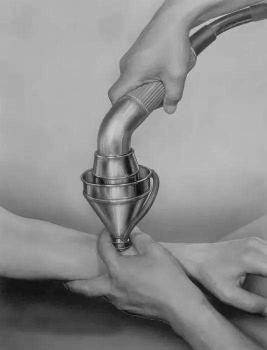 Framed Print : Historic photograph, ultrasonic device