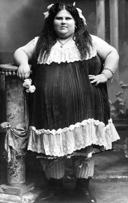 Framed Print : Historical photo, obese woman, ca. 1915