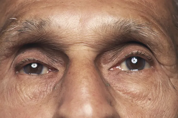 Framed Print : Human body old man eyes, India Framed Print : Human body old man eyes, India