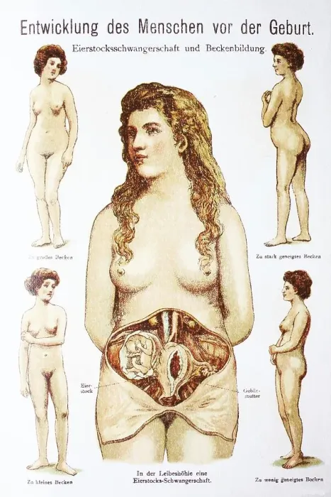 Framed Print : Human pre-birth development in woman Framed Print : Human pre-birth development in woman