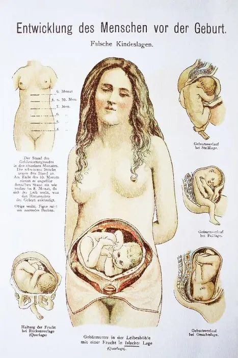 Framed Print : Human pre-birth development in woman Framed Print : Human pre-birth development in woman