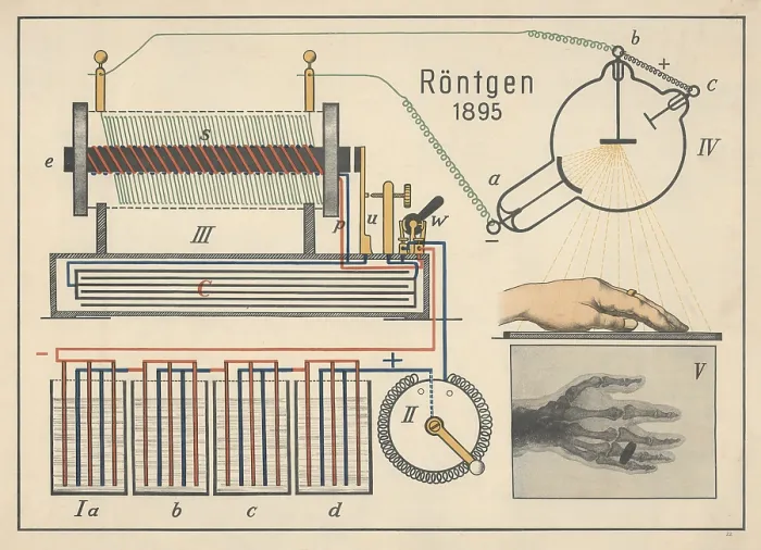 Framed Print : The illustration shows the first X-ray image of a human hand Framed Print : The illustration shows the first X-ray image of a human hand