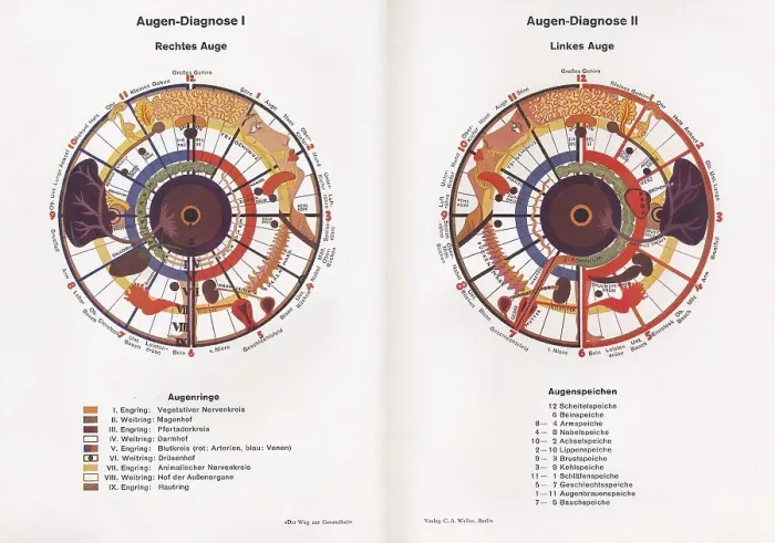 Framed Print : Iridology, alternative medicine, c