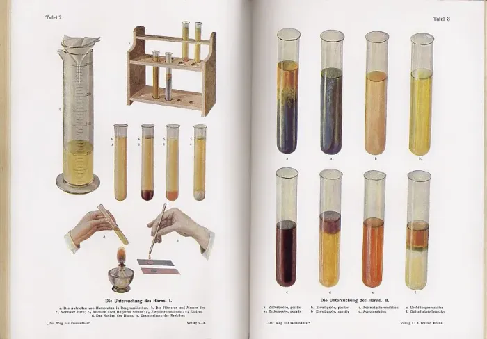 Framed Print : Laboratory analysis of urine, c