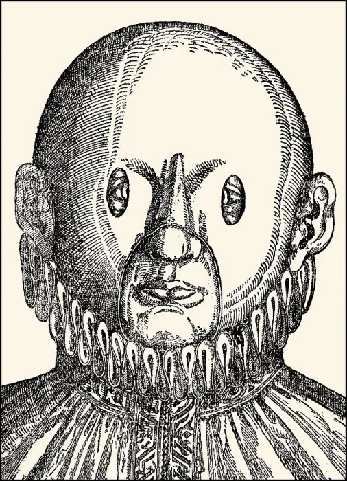 Framed Print : Mask to cure strabismus, Georg Bartisch