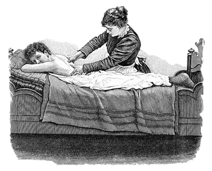 Framed Print : Back massage, historical illustration from: Anna Fischer Dueckelmann Framed Print : Back massage, historical illustration from: Anna Fischer Dueckelmann