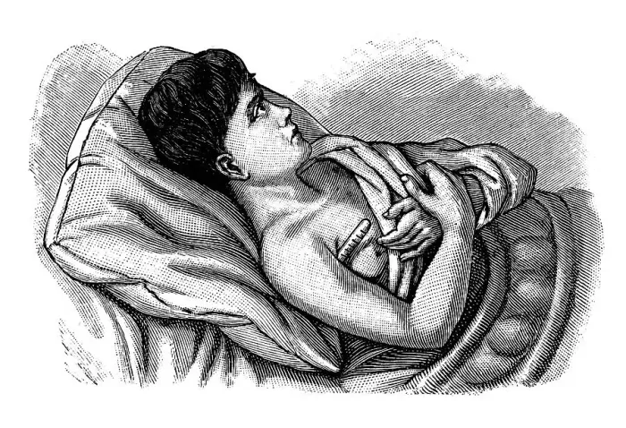 Framed Print : Measuring body temperature, historical illustration