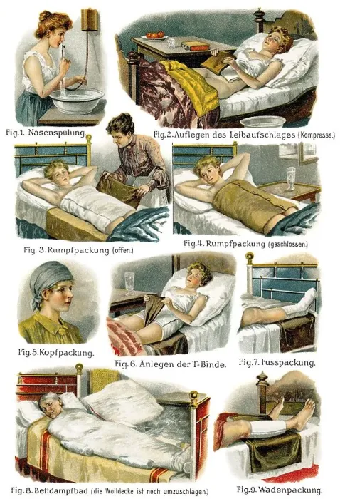 Framed Print : Medical bandaging, 19th Century health guide illustration Framed Print : Medical bandaging, 19th Century health guide illustration