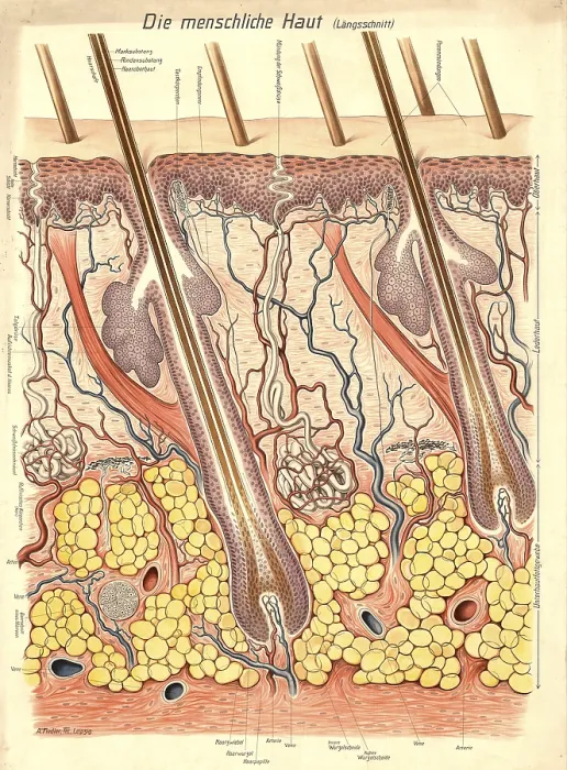 Framed Print : Medical illustration, structure of human skin Framed Print : Medical illustration, structure of human skin