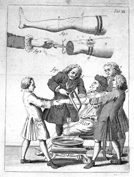 Framed Print : Medicine, Anatomy, Surgery, The Elements of Surgery