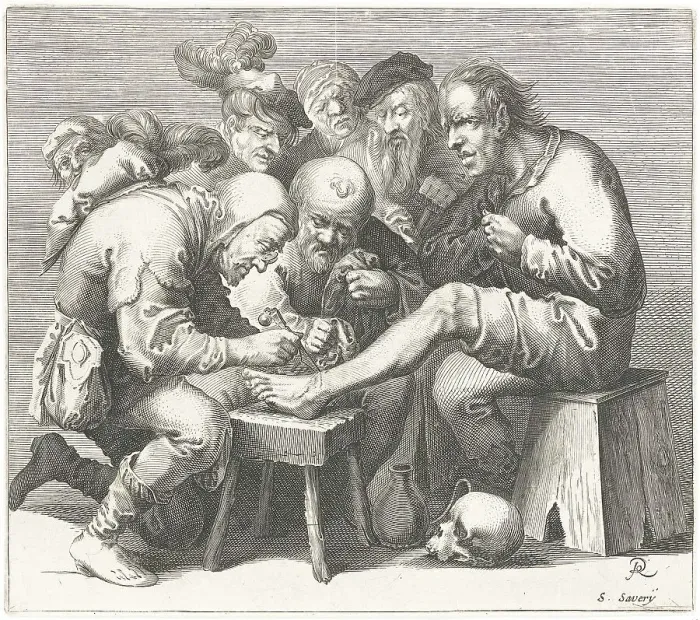Framed Print : Medicine, Anatomy, Surgery on the Foot Framed Print : Medicine, Anatomy, Surgery on the Foot