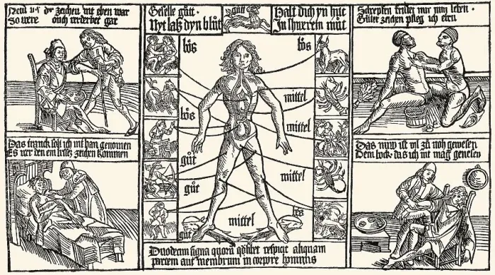 Framed Print : Medicine treatment, bloodletting procedure