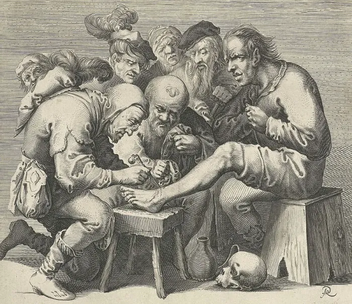 Framed Print : Operation on the foot for teaching purposes by a doctor in the Middle Ages many students are present Framed Print : Operation on the foot for teaching purposes by a doctor in the Middle Ages many students are present