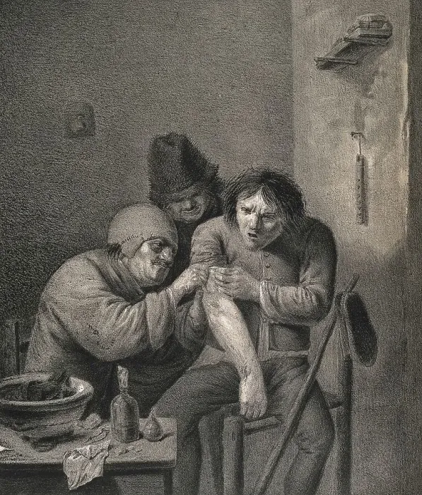 Framed Print : A surgeon dresses the wound of a grimacing patient