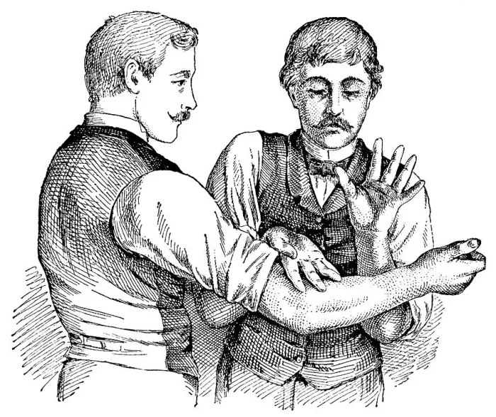 Framed Print : Tapotement massage technique, state of the art of therapeutic techniques