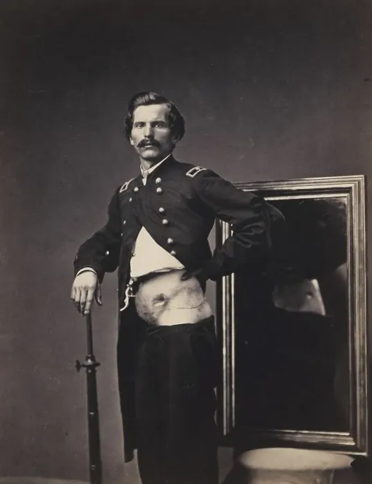 Framed Print : War wounded, Major H. A. Barnum Framed Print : War wounded, Major H. A. Barnum