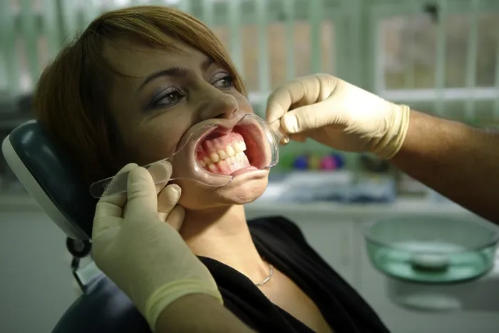 Framed Print : Woman, 39 years, dental examination Framed Print : Woman, 39 years, dental examination
