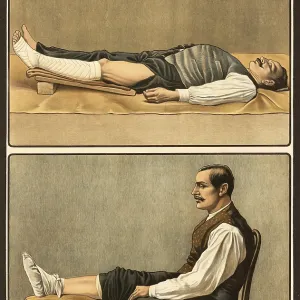 First aid, emergency bandage for varicose bleeding and injuries