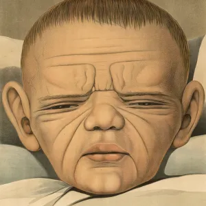 Medical illustration, clinical picture