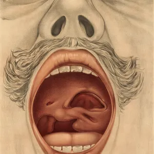 Medical illustration, clinical picture