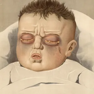 Medical illustration, clinical picture