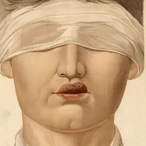 Medical illustration, clinical picture