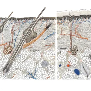 Medical illustration, cut through human skin and hair root