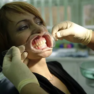 Woman, 39 years, dental examination